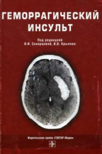 Книга Геморрагический инсульт. Практическое руководство.