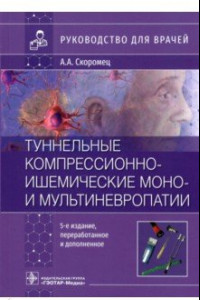 Книга Туннельные компрессионно-ишемические моно- и мультиневропатии. Руководство для врачей