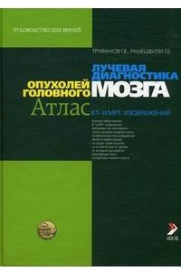 Книга Лучевая диагностика опухолей головного мозга. Атлас КТ- и МРТ-изображений. Руководство для врачей