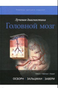 Книга Лучевая диагностика. Головной мозг