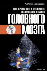 Книга Допплерография и дуплексное сканирование сосудов головного мозга