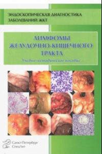 Книга Лимфомы ЖКТ. Учебно-методическое пособие