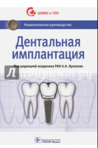 Книга Дентальная имплантация. Национальное руководство