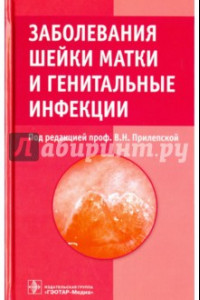 Книга Заболевания шейки матки и генитальные инфекции