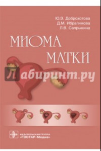 Книга Миома матки. Руководство