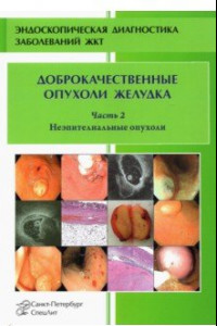 Книга Доброкачественные опухоли желудка. Часть 2. Неэпителиальные опухоли