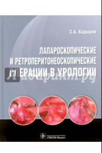 Книга Лапароскопические и ретроперитонеоскопические операции в урологии