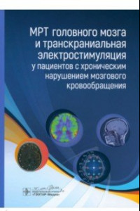 Книга МРТ головного мозга и транскраниальная электростимуляция у пациентов с хроническим нарушением