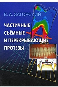 Книга Частичные съемные и перекрывающие протезы